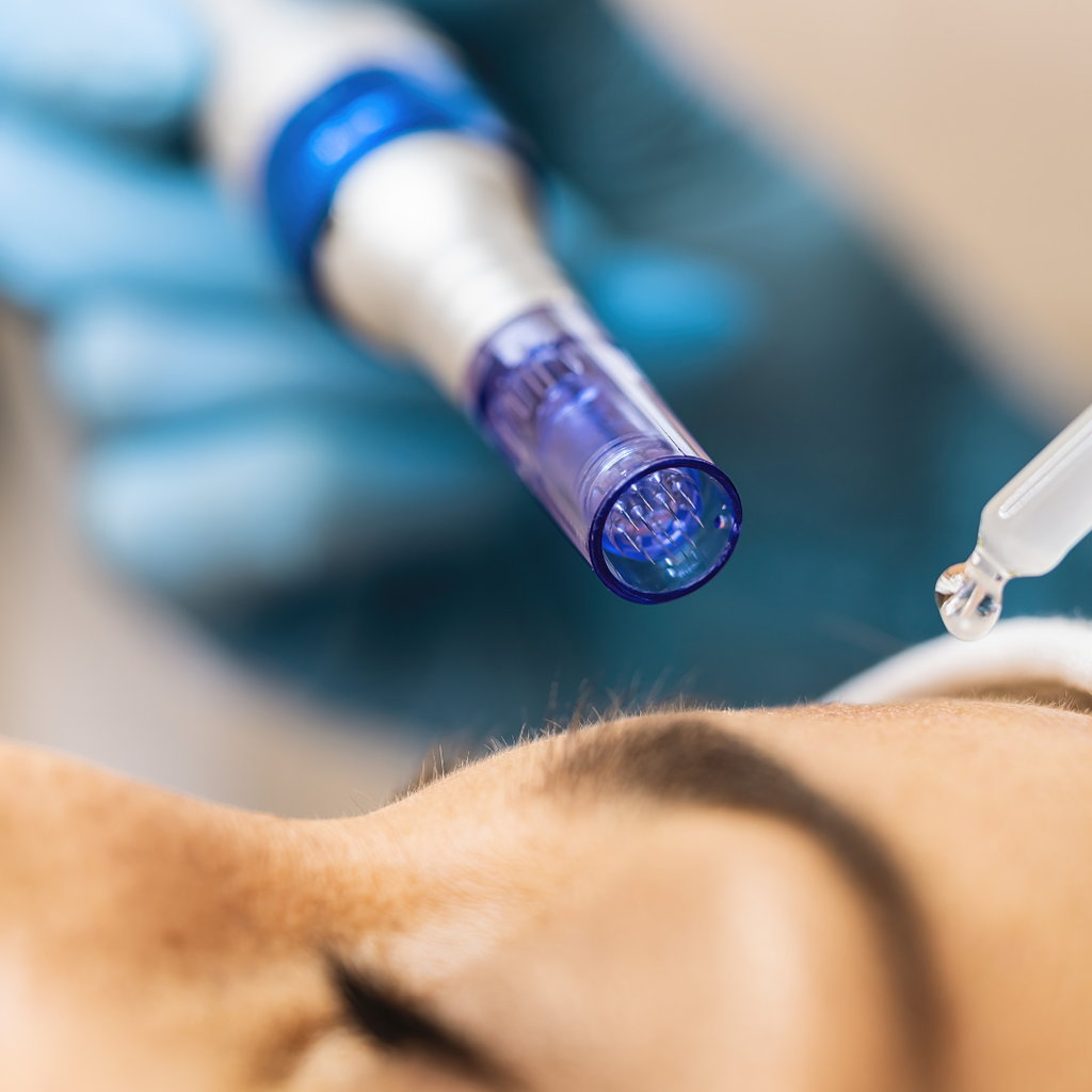 Dermapen