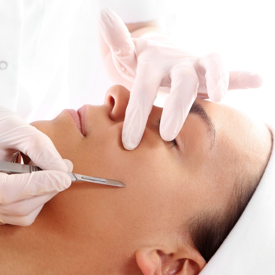Dermaplaning
