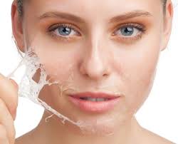 Peeling Químico